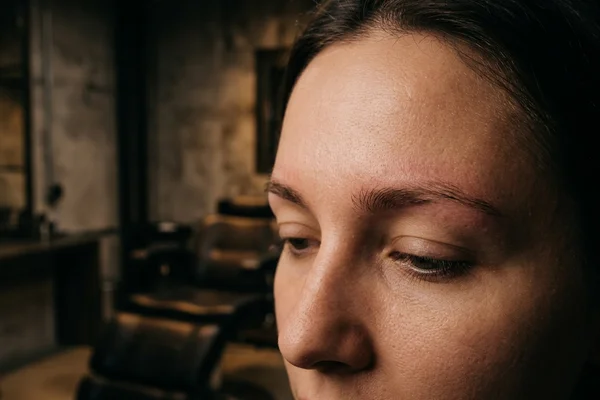 The same brows cleared of shifted pigment with natural skin tone restored