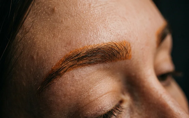 Close-up of microbladed brows showing warm orange-toned pigment shift before laser lightening