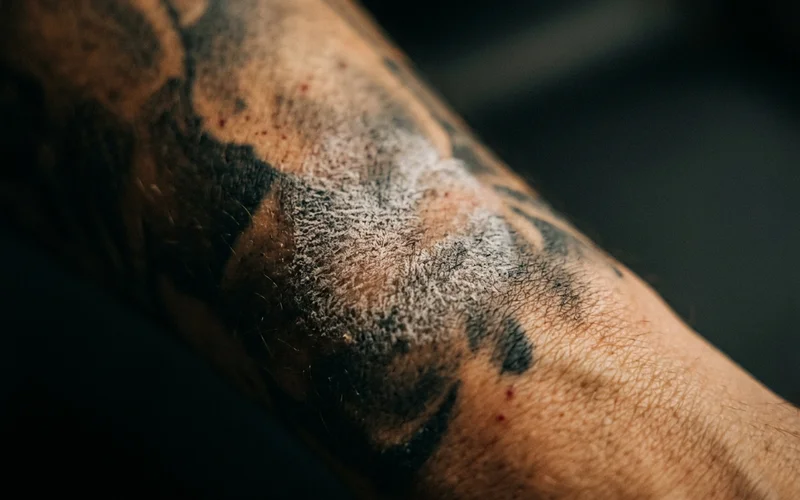 Macro shot of tattooed skin mid-treatment showing the white frosting reaction