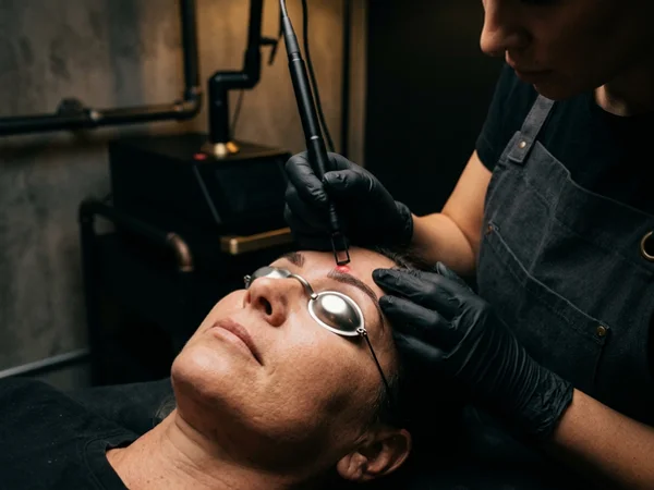 Precision laser treatment of microbladed eyebrows with protective eye shields in place