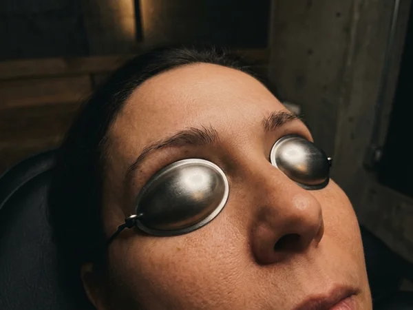 Rigid protective eye shields positioned over a client's eyes during a brow removal session